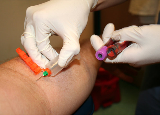 The Critical Role of Phlebotomy Technicians